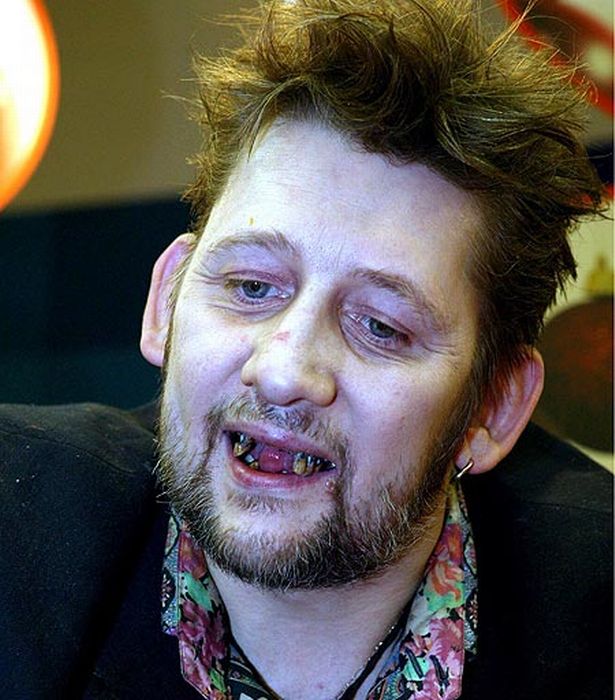 shane-macgowan-teeth.jpg