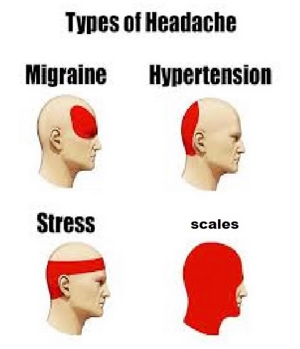 headache.jpeg